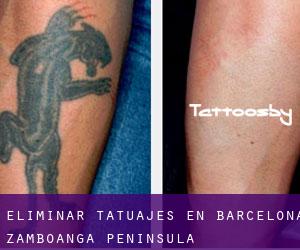 Eliminar tatuajes en Barcelona (Zamboanga Peninsula)