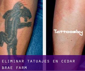 Eliminar tatuajes en Cedar Brae Farm