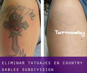 Eliminar tatuajes en Country Gables Subdivision