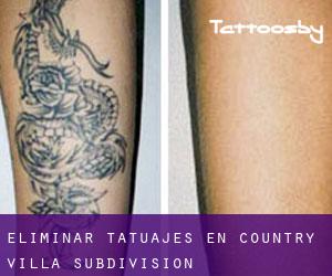 Eliminar tatuajes en Country Villa Subdivision