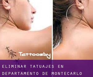 Eliminar tatuajes en Departamento de Montecarlo