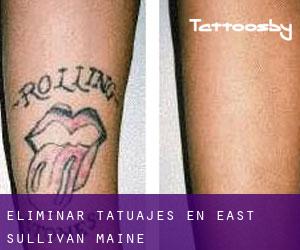 Eliminar tatuajes en East Sullivan (Maine)