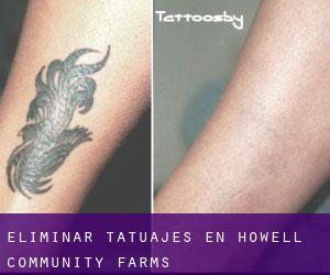 Eliminar tatuajes en Howell Community Farms