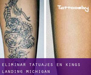 Eliminar tatuajes en Kings Landing (Michigan)