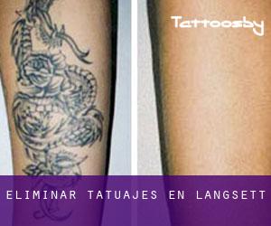Eliminar tatuajes en Langsett