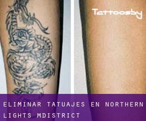 Eliminar tatuajes en Northern Lights M.District