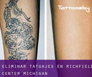 Eliminar tatuajes en Richfield Center (Michigan)