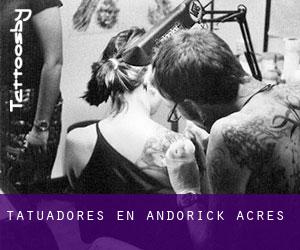 Tatuadores en Andorick Acres