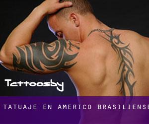 tatuaje en Américo Brasiliense