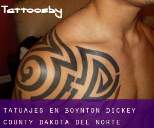 tatuajes en Boynton (Dickey County, Dakota del Norte)