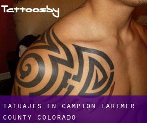 tatuajes en Campion (Larimer County, Colorado)