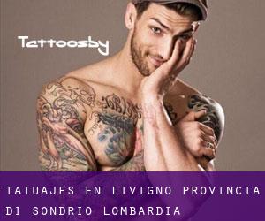 tatuajes en Livigno (Provincia di Sondrio, Lombardía)